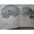 ATLAS DE VASCULARISATION ARTERIELLE DU CERVEAU CHEZ L'HOMME - ATLAS OF THE ARTERIES OF THE-HUMAN-BRAIN -  G. SALAMON (franceza si engleza)